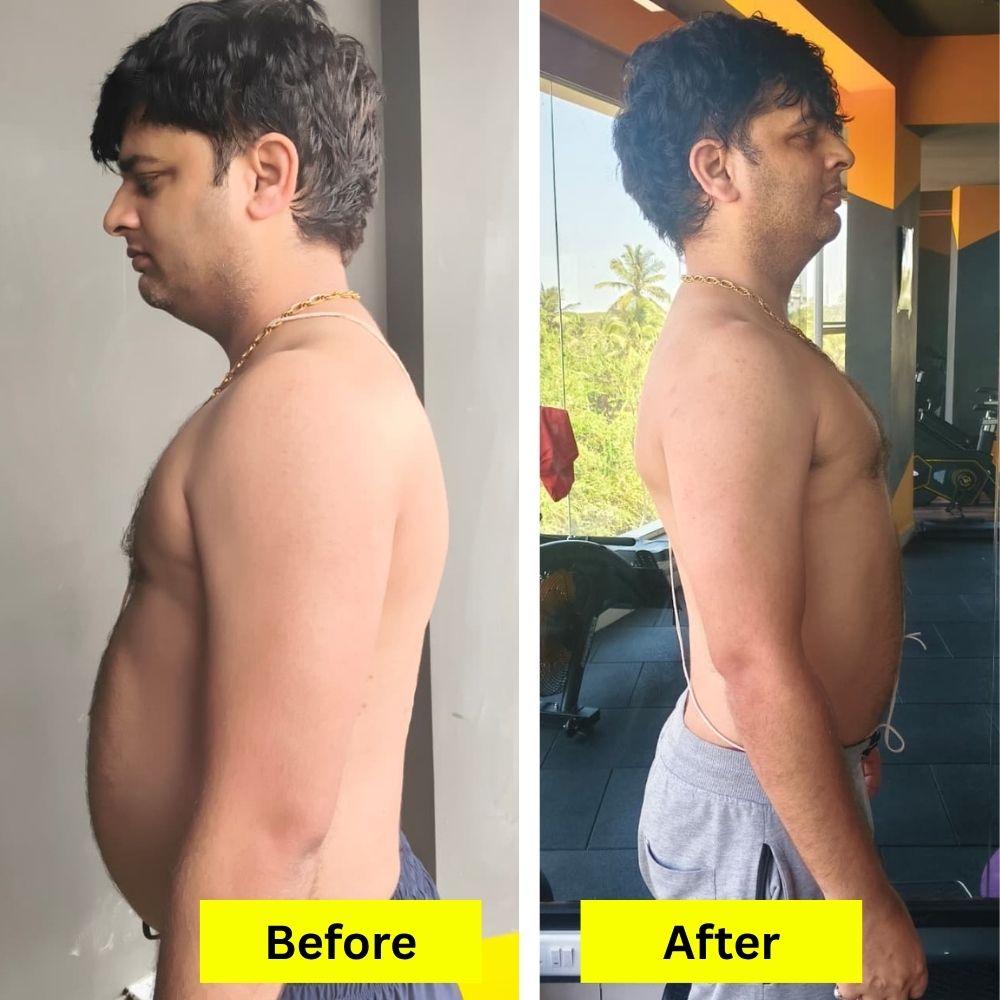 before-after (3)