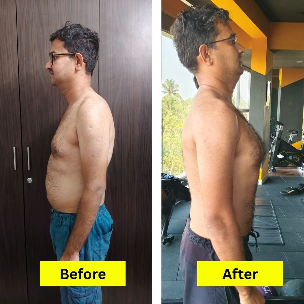 before-after (4)